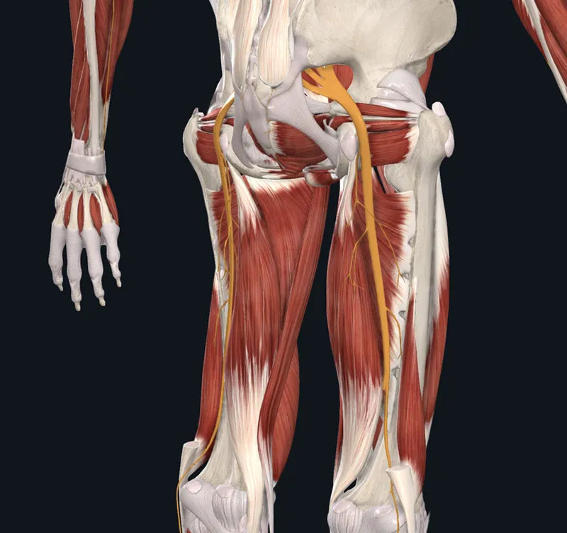Sciatica and the Proverbial Fork in the Road