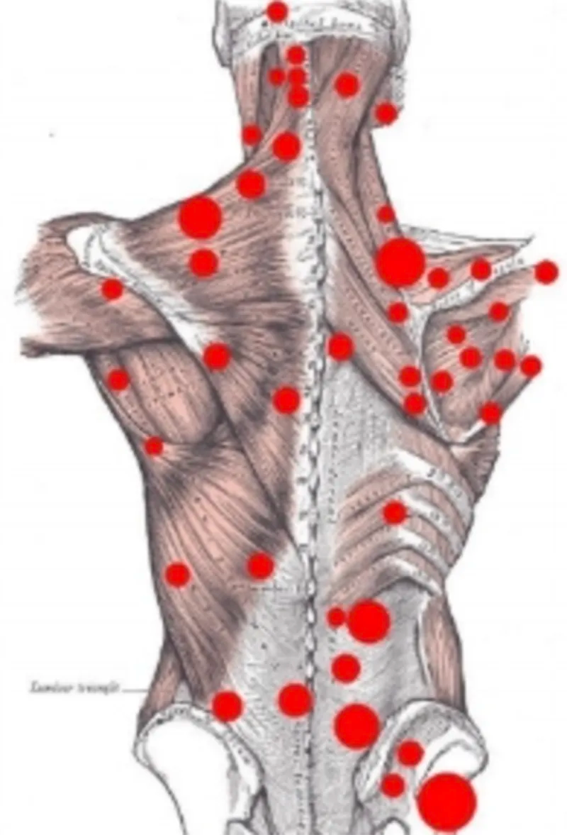 The Philosophical Truth About Trigger Points