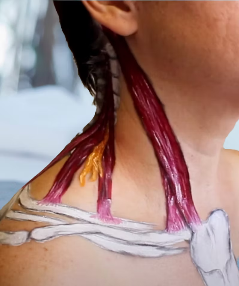 Sternocleidomastoid Massage Tutorial